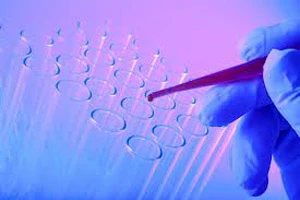 Первый цикл проекта по ранней диагностике рака предстательной железы дал положительные результаты