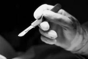 В Беларуси может быть введен возрастной ценз на добровольную стерилизацию